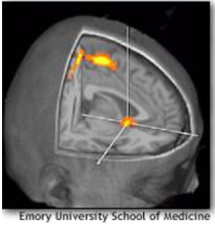 A graphic illustrated how the nucleus accumbents activates in the response to an unexpected event